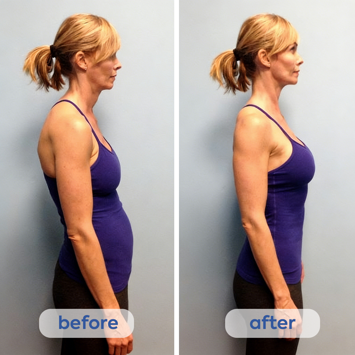 Instant Posture Corrector