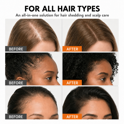 Stop Treating Your Hair. Start Treating Your Scalp.